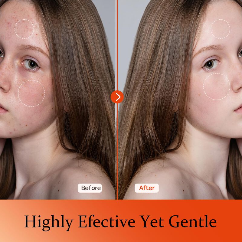 Suero Facial KGDYQZQ Vitamina C 30ml Antienveje... image number null