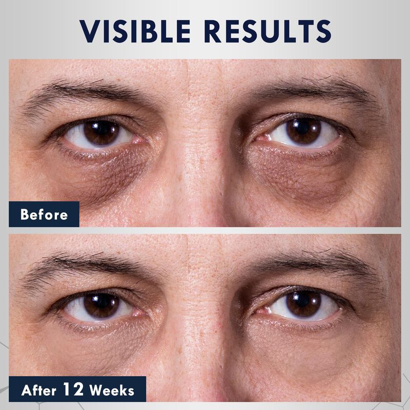 Suero Para Ojos Oxbraver 15 ml con Rodillo de C... image number null
