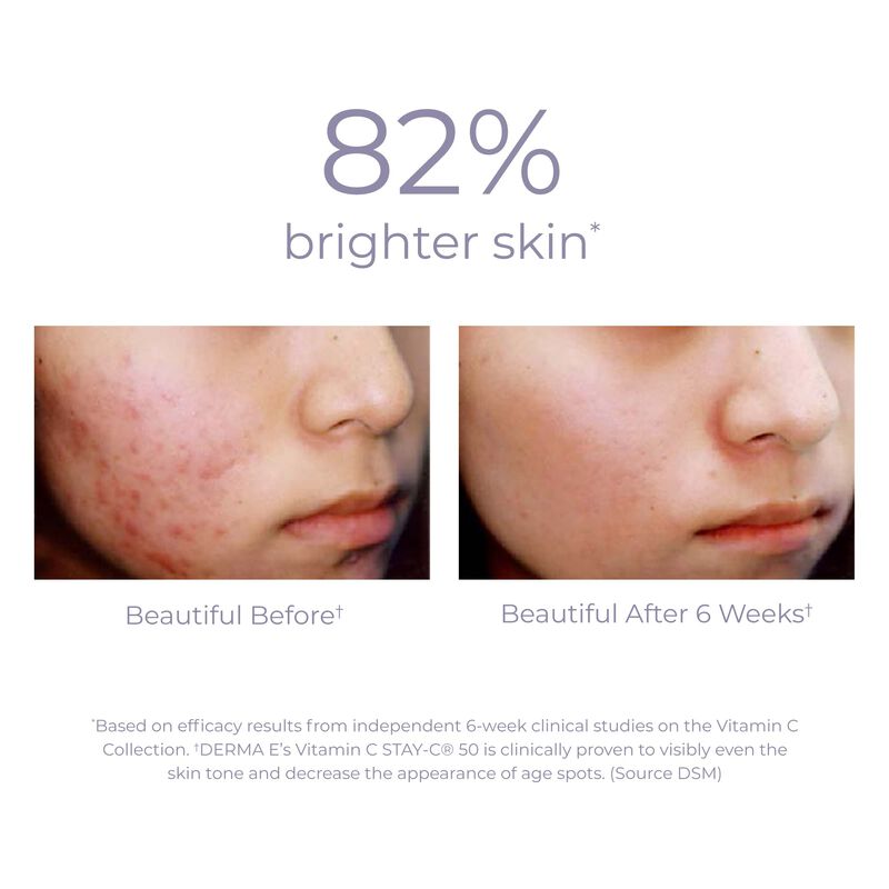S&eacute;rum De Vitamina C Derma E 10% Con Niacinamida... image number null