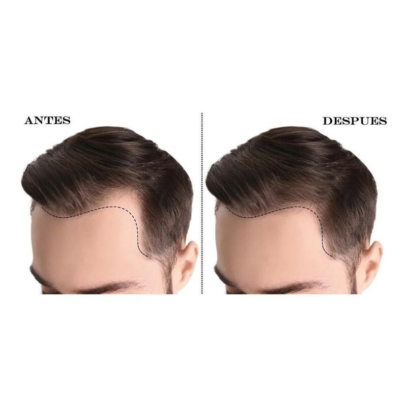 Kit Loción Crecimiento Capilar Y Super Hold Pom... image number null