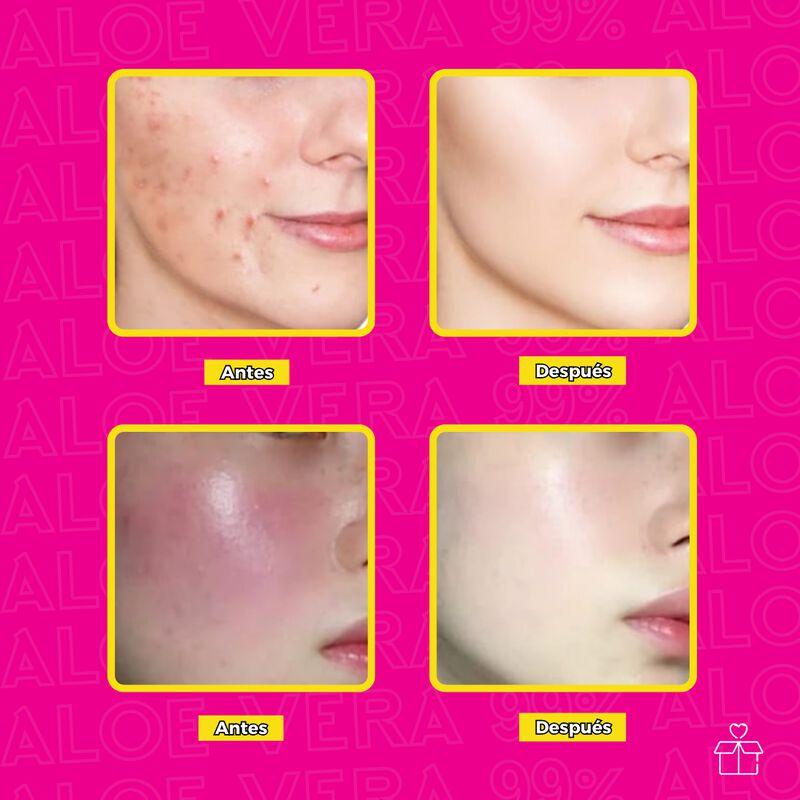 Pack 3 Gel Aloe Vera Anti-manchas Anti-acne Vit... image number null