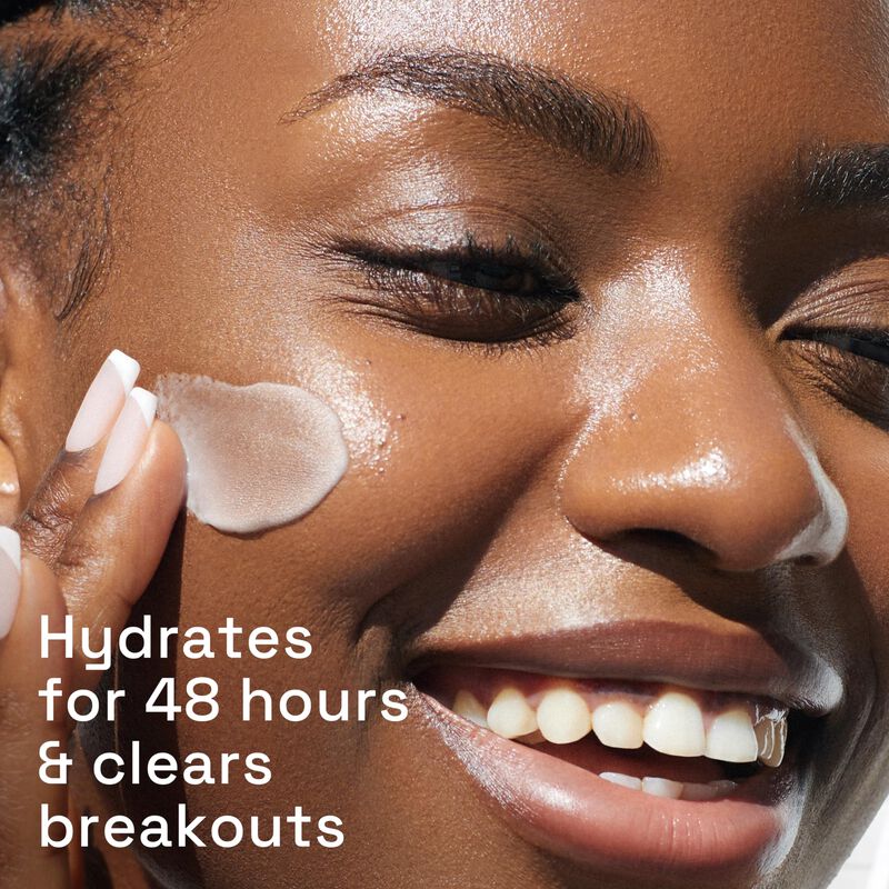 Crema Hidratante Cetaphil Gentle Clear Matifica... image number null
