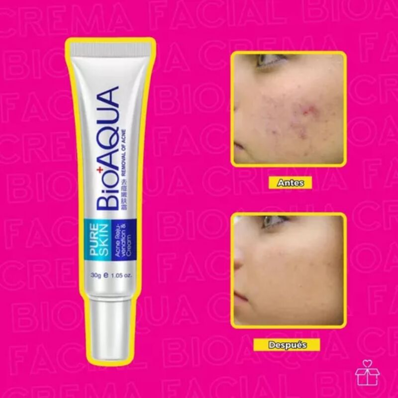 Crema Anti Ácne Bioaqua Pure Skin Cicatrices Co... image number null