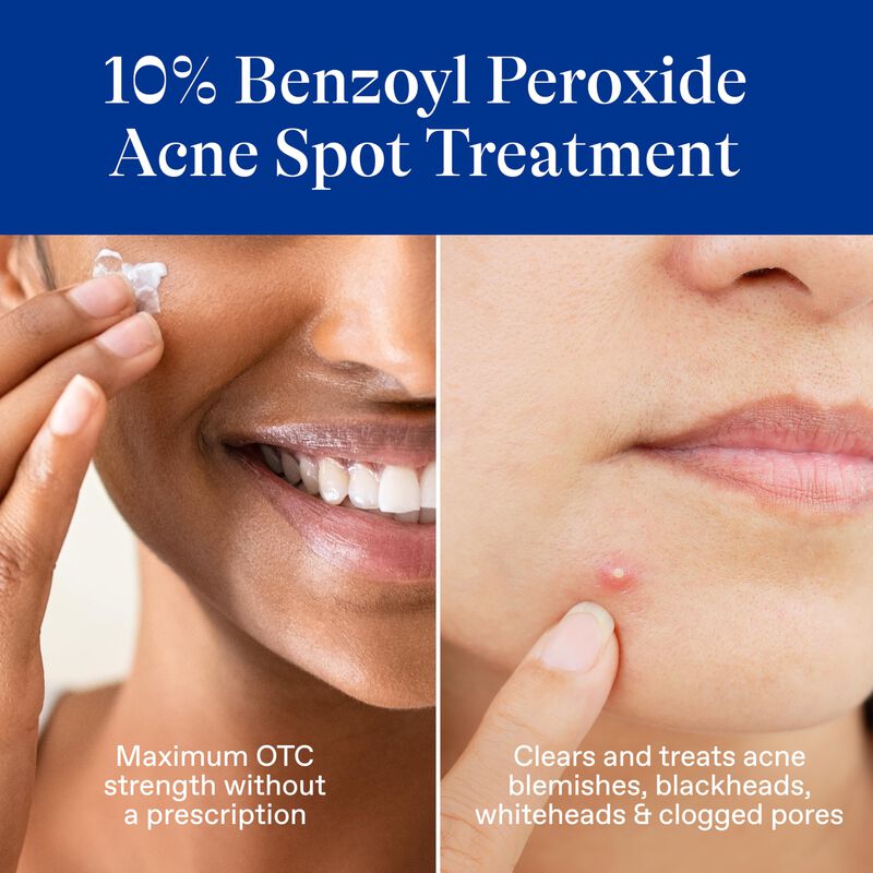 Tratamiento Localizado Differin Acne Con Per&oacute;xi... image number null