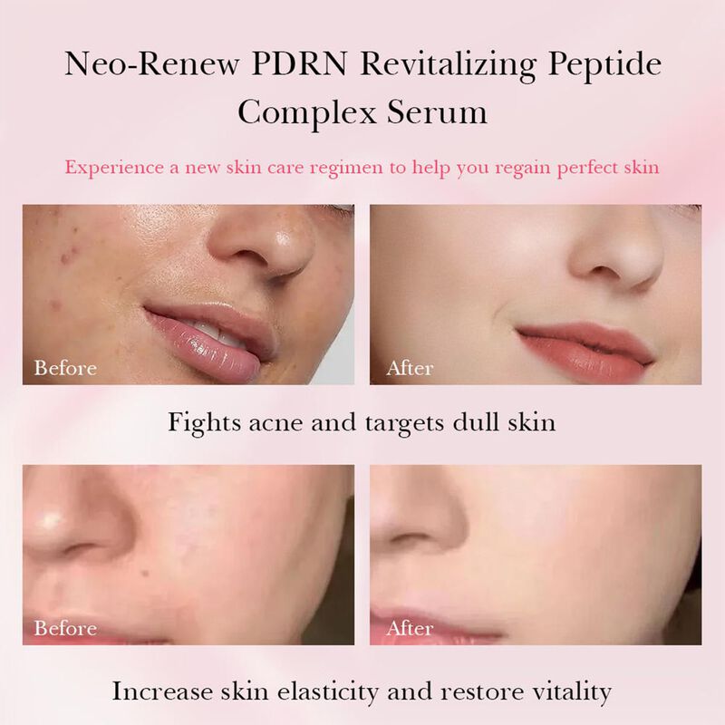 Suero Facial Naadea Pdrn 30ml con Col&aacute;geno Pept... image number null