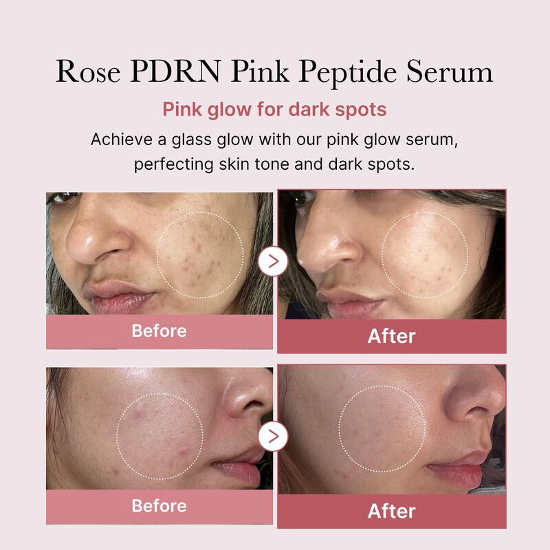 Serum Medicube Rose Pdrn Pdrn Pink Peptide Para... image number null