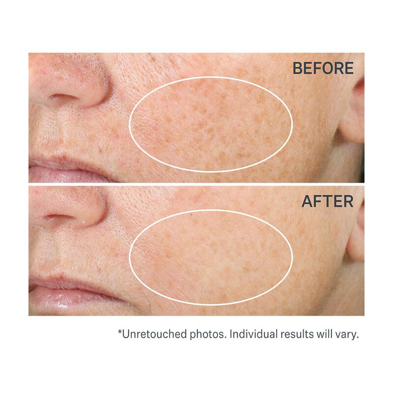 S&eacute;rum Strivectin Super C Retinol Brighter & Cor... image number null