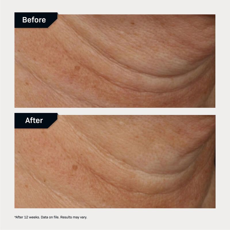 Crema Reafirmante Para Cuello Revision Skincare... image number null