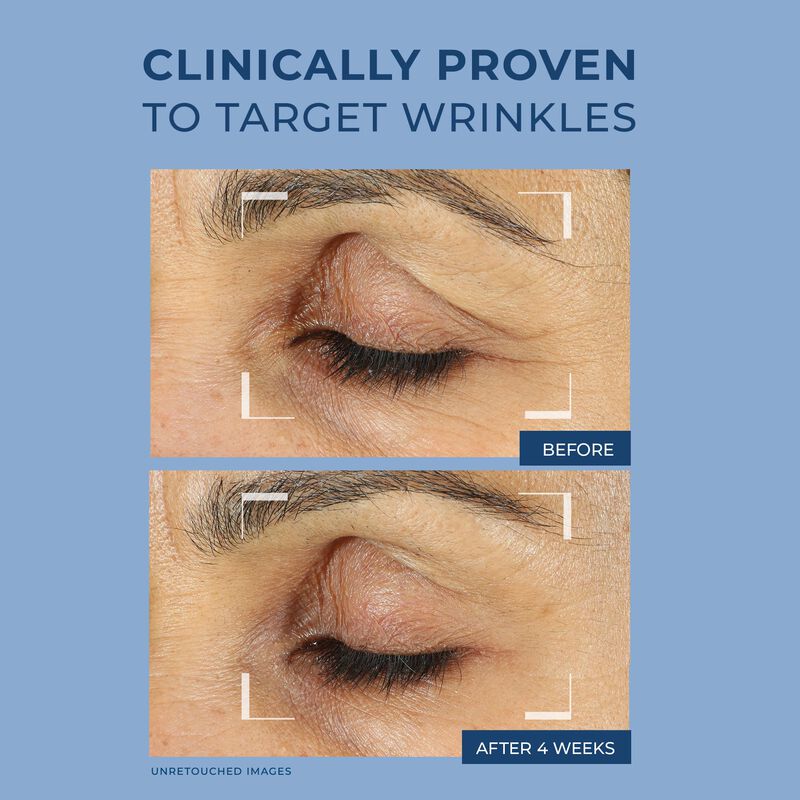 Crema De Ojos Roc Retinol Correxion Para Ojeras... image number null