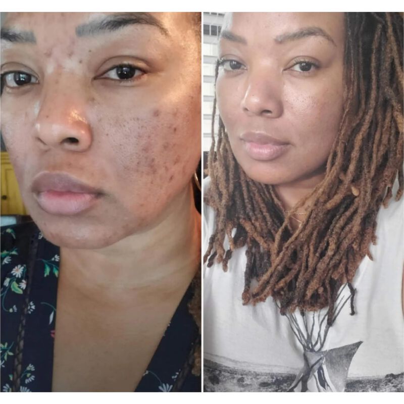 Exfoliante Facial Kiaeva 30 ml image number null