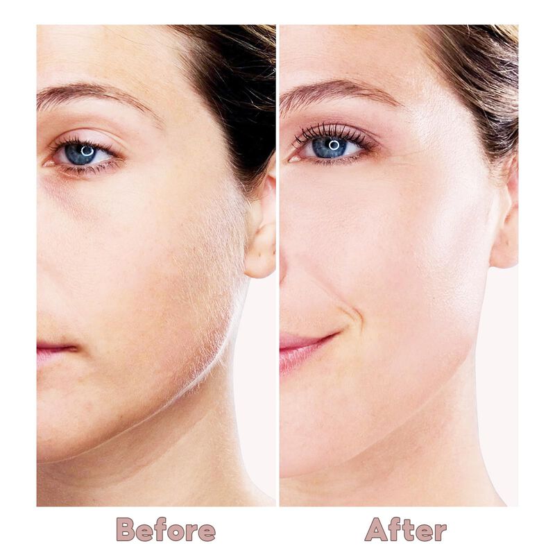 Dispositivo De Depilaci&oacute;n Facial Innobeaut Para... image number null
