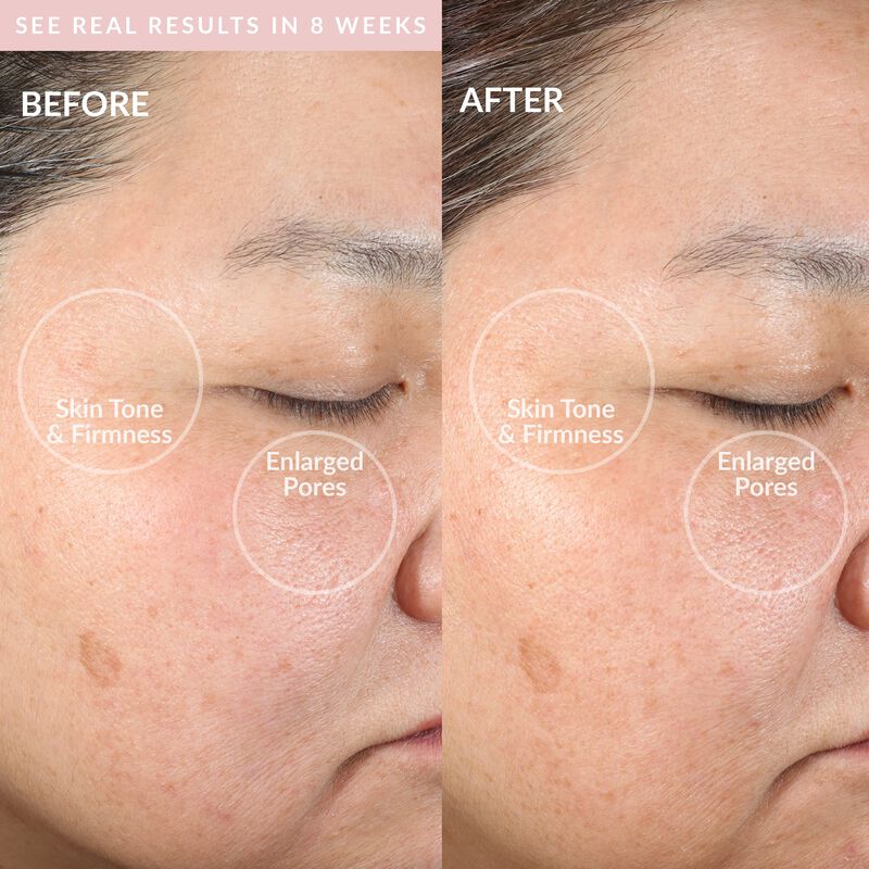 Dispositivo De Limpieza Facial Pmd Clean Con Ce... image number null