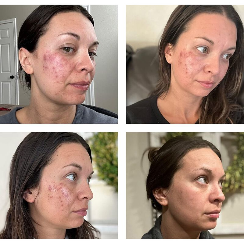 Exfoliante Facial Kiaeva 30 ml image number null