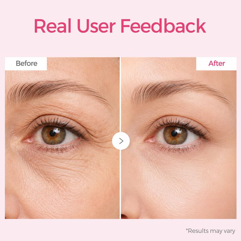 Parches Oculares Blisskin PDRN y P&eacute;ptidos Anti-... image number null