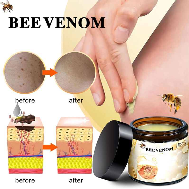 Crema De Veneno De Abeja Iekufes New Profession... image number null