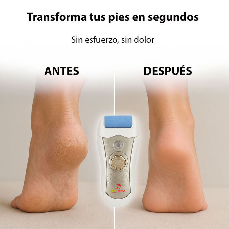 Depiladora Todo En Uno Epi Tome 2 Velocidades R... image number null