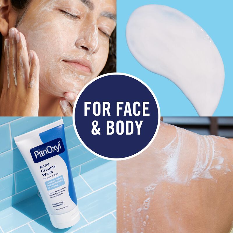 Panoxyl Crema Facial Antiacn&eacute; 4% Per&oacute;xido De Be... image number null