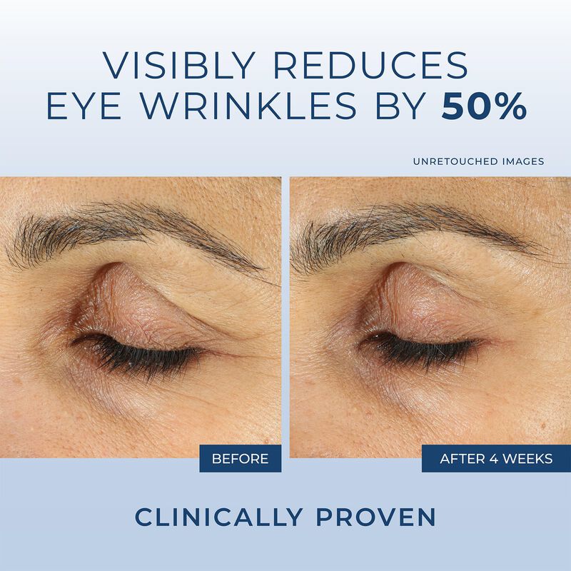 Crema De Ojos Roc Retinol Correxion Para Ojeras... image number null