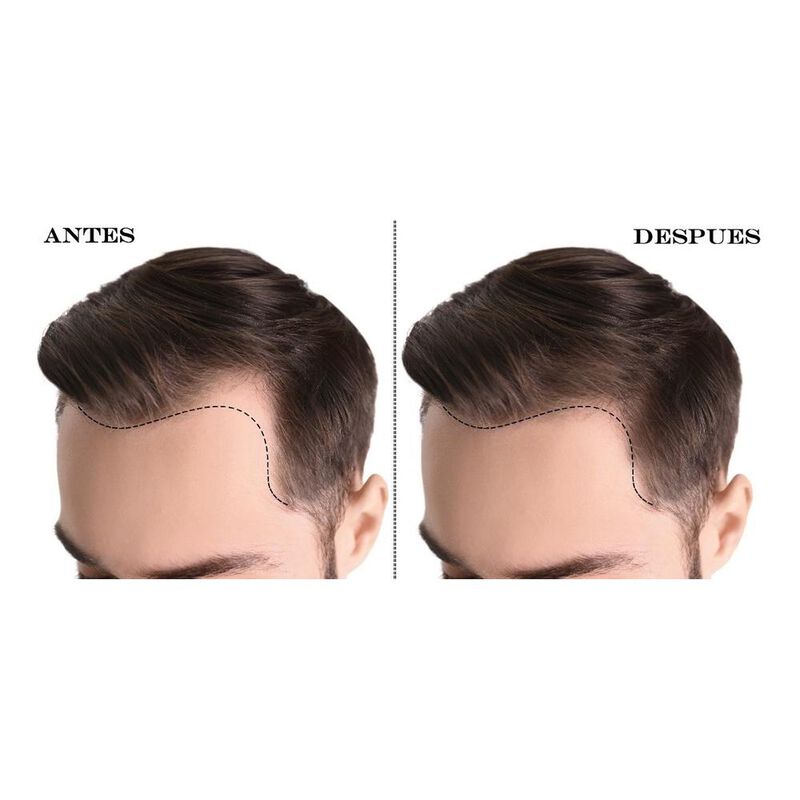 Kit Estimulador Crecimiento De Cabello Unisex T... image number null
