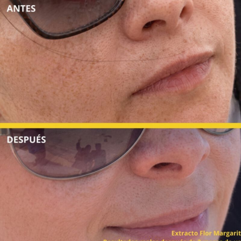 BRIDUNN SKINCARE Crema Despigmentante Facial An... image number null