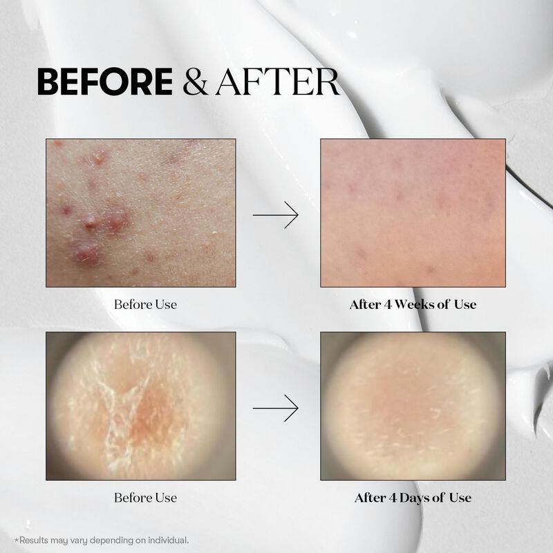 Serum Vt Cosmetics Cica Reedle Shot 700 Tratami... image number null
