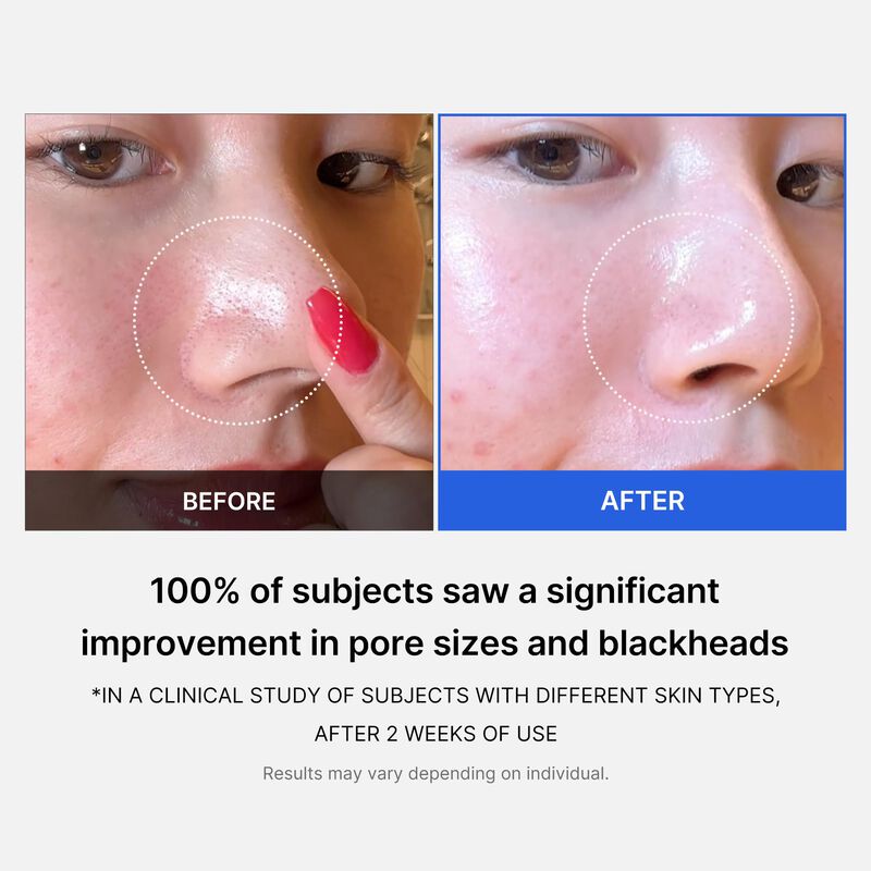 Almohadillas De T&oacute;ner Facial Medicube Zero Pads... image number null