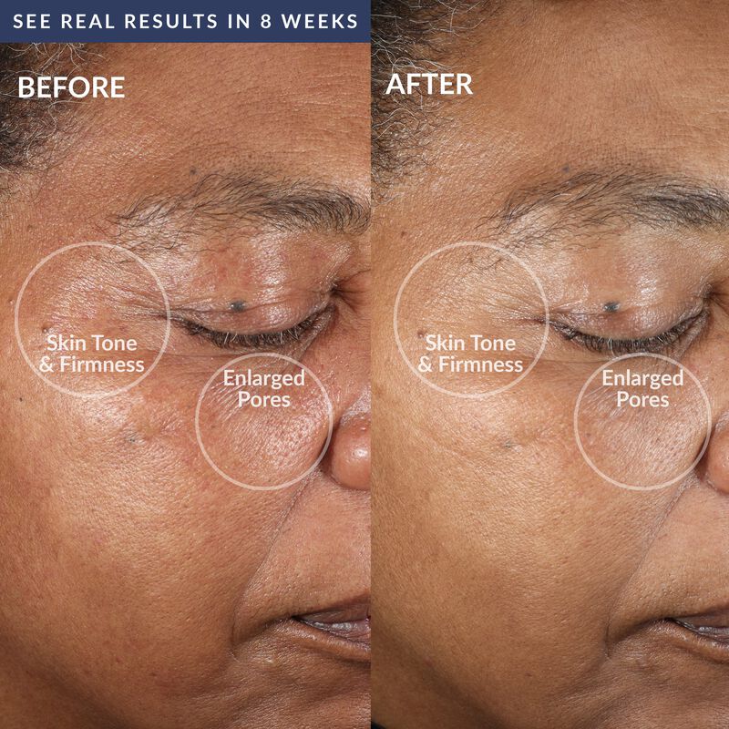 Dispositivo De Limpieza Facial Pmd Clean Pro Si... image number null