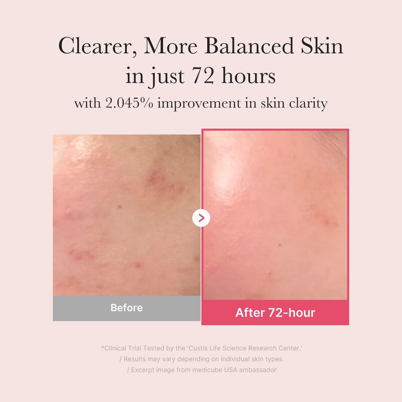 S&eacute;rum Facial Medicube Txa+niacinamida 15% Glow ... image number null