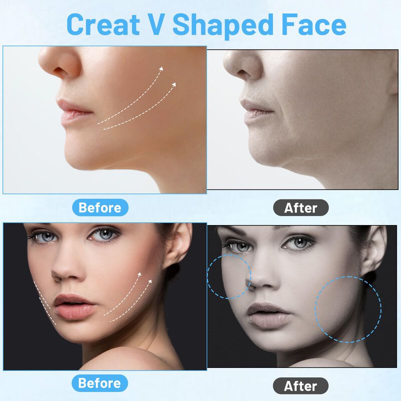 Cinta de Lifting Facial Gsbnjuy 156 Piezas Tran... image number null