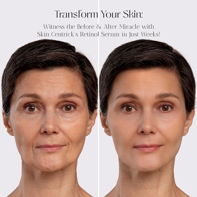 Suero de Retinol image number null