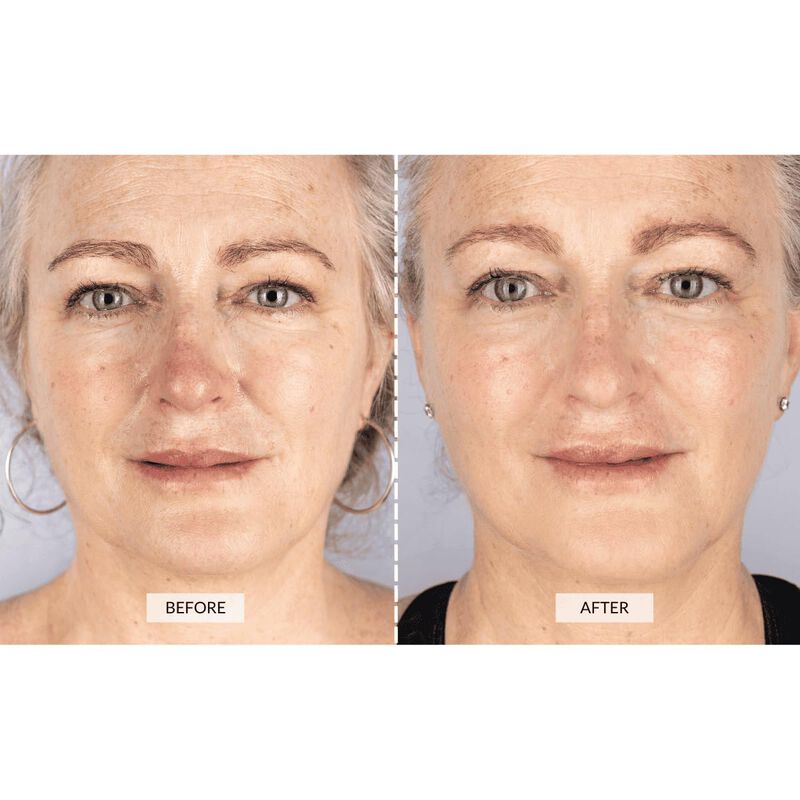 Mascarilla Facial LED CurrentBody Skin Rojo e I... image number null