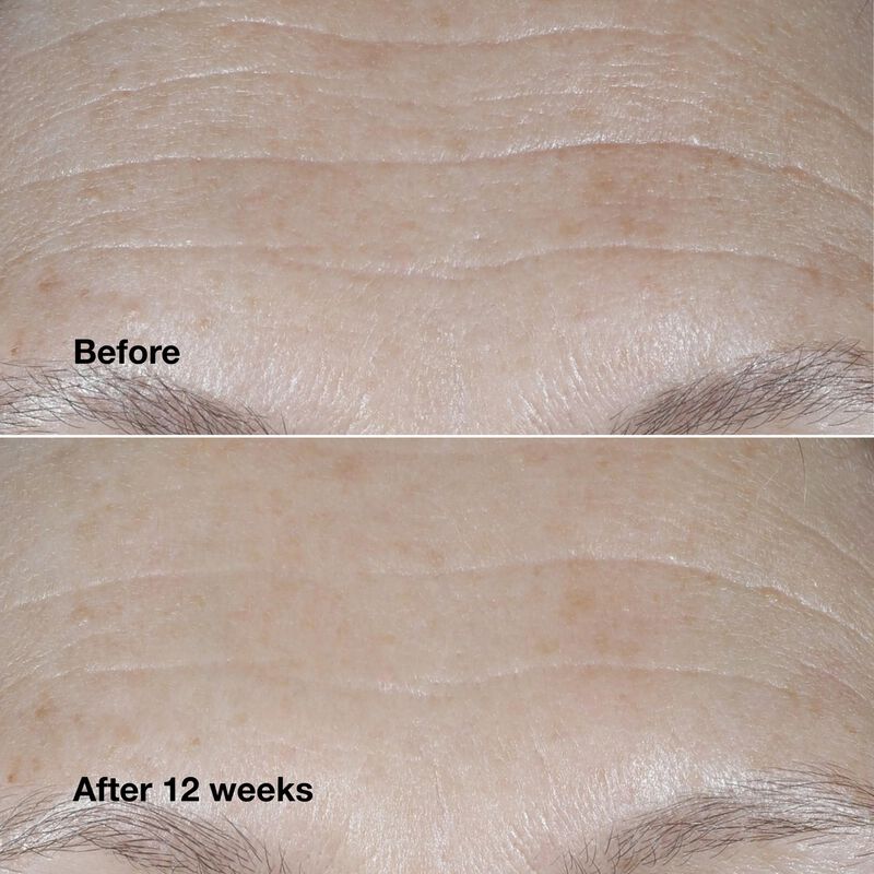 Crema Hidratante Clinique Smart Clinical Repair... image number null