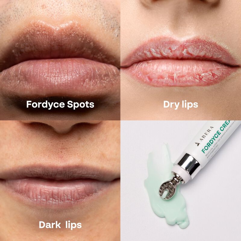 Crema De Labios Abera Abera Fordyce Con Hpr Par... image number null