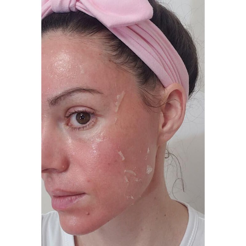 Exfoliante Qu&iacute;mico Tcatherapycare 30ml 50% TCA image number null