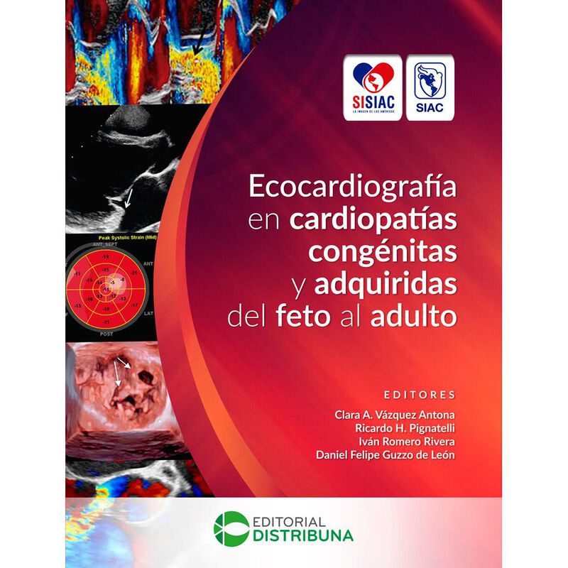 Ecocardiograf&iacute;a en cardiopat&iacute;as cong&eacute;nitas y ad... image number null