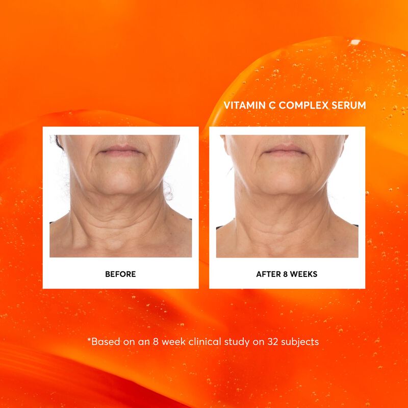 Serum Naturium Complejo Facial Vitamina C 30 Ml image number null