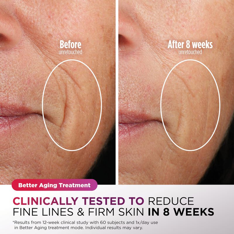 Mascarilla Facial Led Shark Cryoglow Con Refrig... image number null