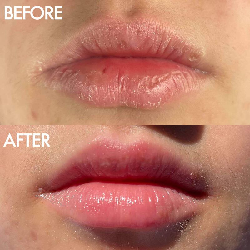 B&aacute;lsamo Labial Lanolips 101 Ointment Multi-balm... image number null