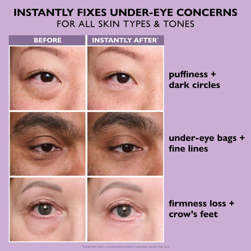 Estirador De Ojos Peter Thomas Roth Instant Fir... image number null
