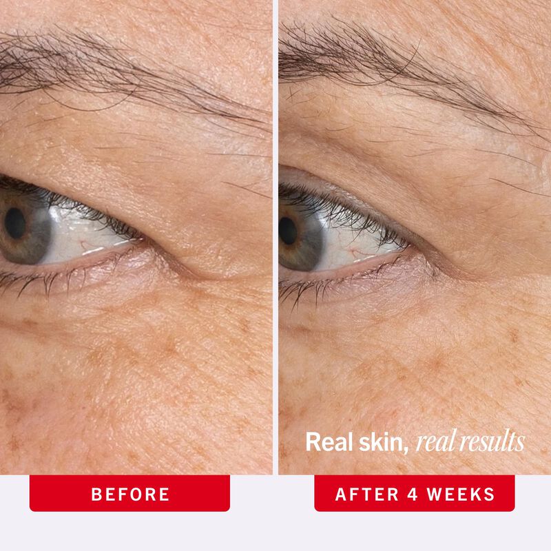 Crema para Ojos Ultra Repair First Aid Beauty 1... image number null