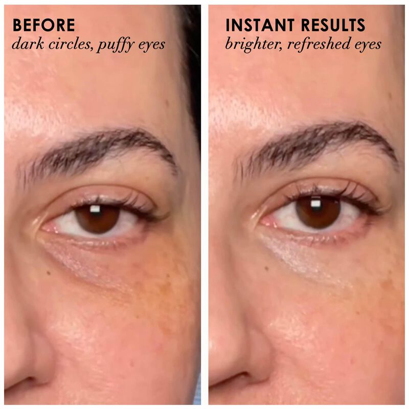 Crema Para Ojos Dermelect 15ml Revitalite image number null