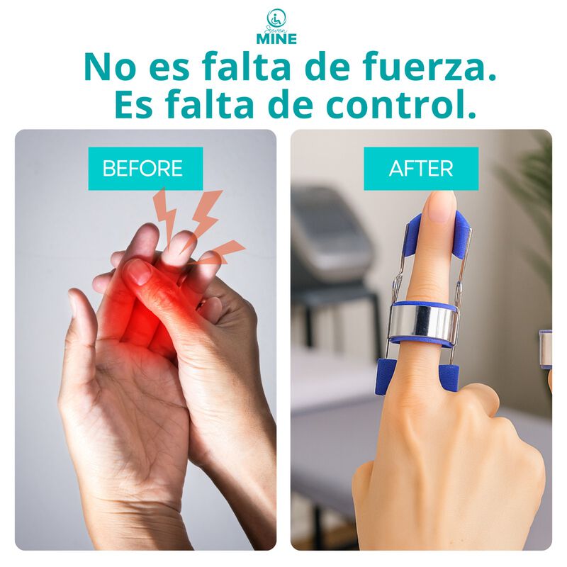 Ejercitador de Dedos con Resorte Progresivo par... image number null