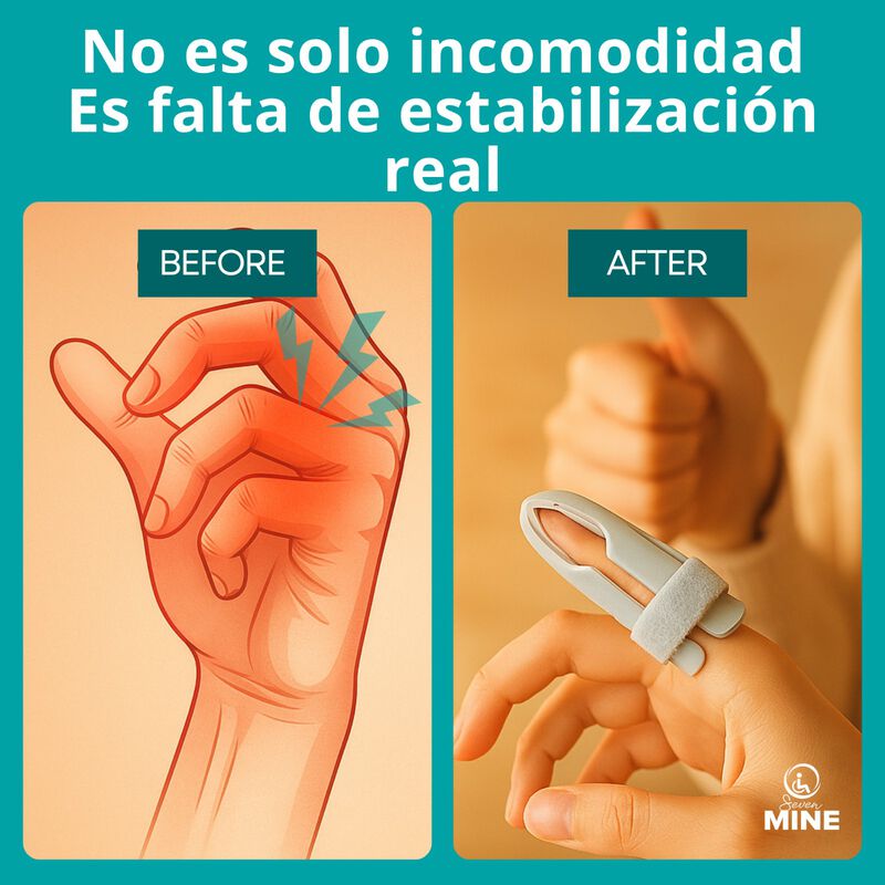 F&eacute;rula Para Dedo Tipo Sombrilla Inmovilizador |... image number null