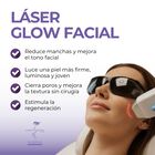 Laser Glow Facial (rejuvenecimiento Facial Con L&aacute;ser) 10 Citas