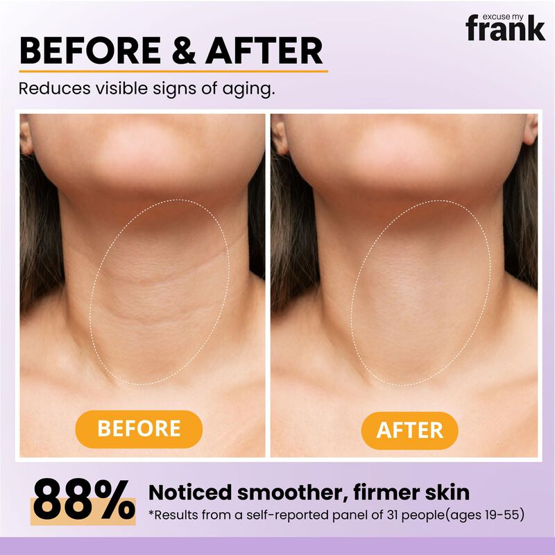 Crema Facial Excuse My Frank 150 g Bakuchiol An... image number null