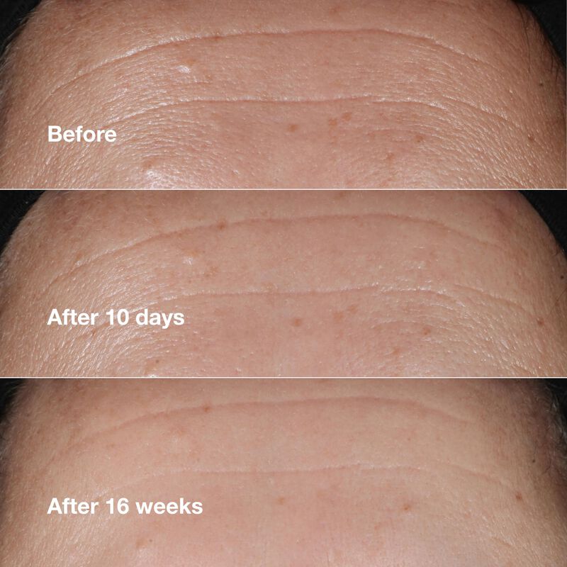 Serum Clinique Smart Clinical Repair, Corrector... image number null