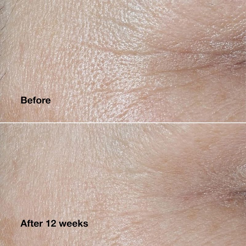 Crema Facial Clinique Smart Clinical Repair Wri... image number null