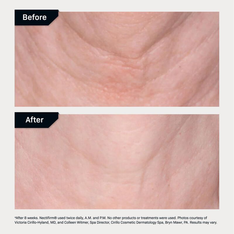 Crema Reafirmante De Cuello Revision Skincare N... image number null