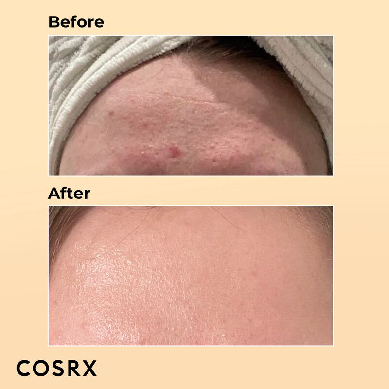 S&eacute;rum Hidratante Cosrx Snail Mucin 96% Power Re... image number null