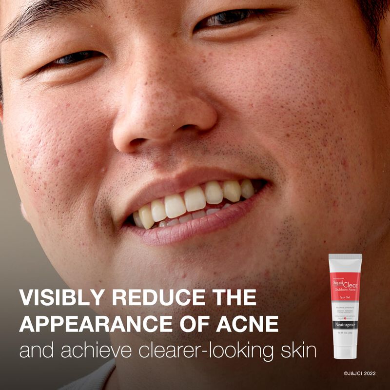 Gel Neutrogena Rapid Clear Para Tratar Las Manc... image number null